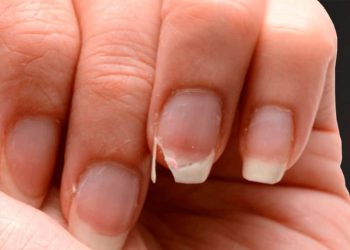 3 astuces pour renforcer ses ongles naturellement