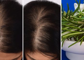 Astuce naturelle pour stopper la chute des cheveux