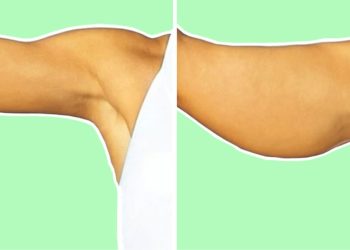 exercices pour les bras