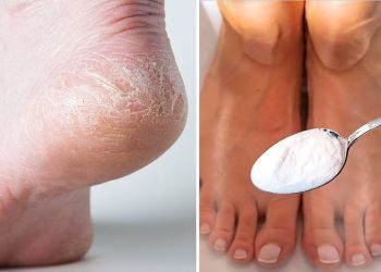 Conseils pour prendre soin de ses pieds en hiver