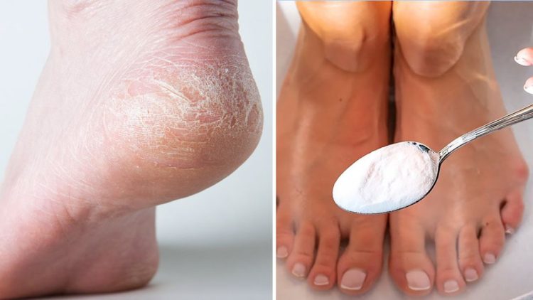 Conseils pour prendre soin de ses pieds en hiver