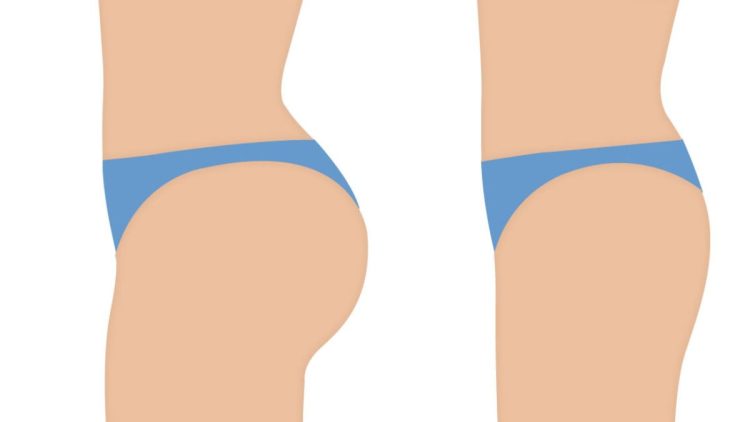 5 exercices magiques pour remonter ses fesses