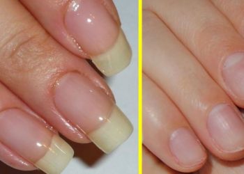 Astuces pour renforcer des ongles avec du bicarbonate de soude