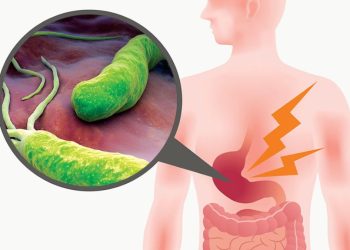 Régime alimentaire spécial Hélicobacter pylori