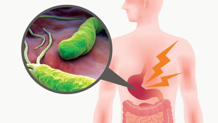 Régime alimentaire spécial Hélicobacter pylori