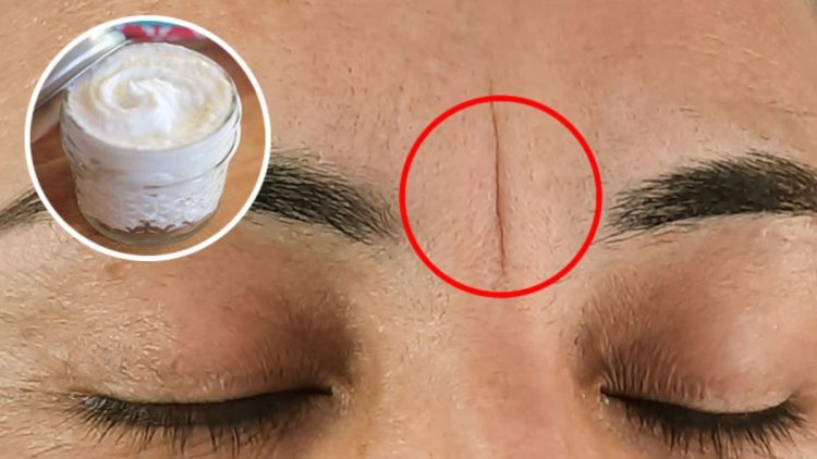 2 masques efficaces pour atténuer naturellement la ride du lion