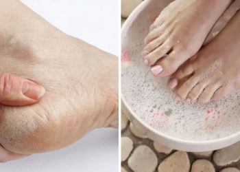 Astuce parfaite pour avoir des pieds beaux et soignés