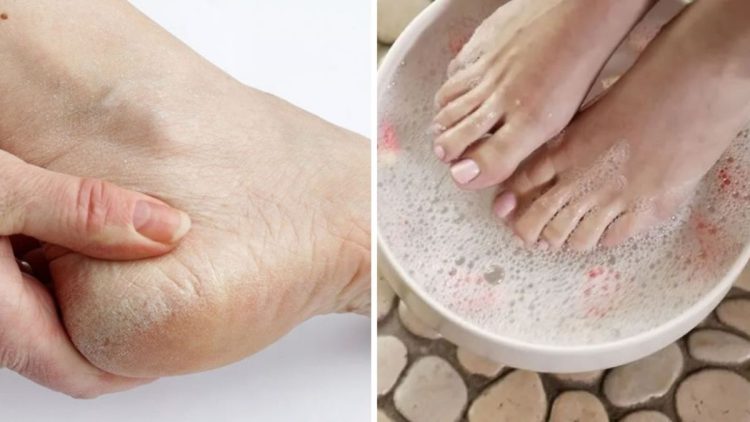 Astuce parfaite pour avoir des pieds beaux et soignés