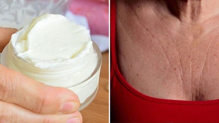 Comment atténuer les rides du cou et du décolleté rapidement