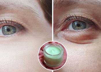 Produit naturel pour soigner le contour des yeux