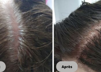 Solution pour éliminer les cheveux gris sans utiliser de colorants