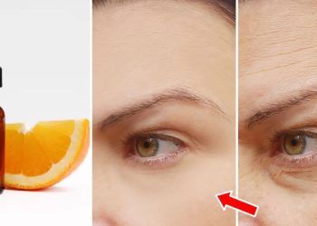 Comment appliquer de la vitamine C sur votre peau