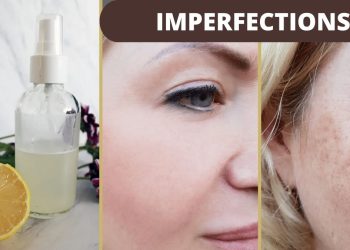 huiles végétales pour le visage adaptées aux peaux à imperfections