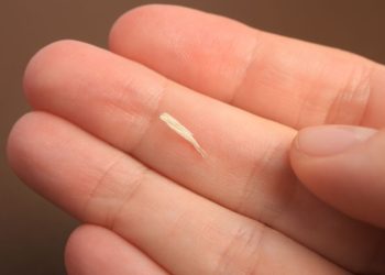 Enlever les échardes avec du bicarbonate de soude : c'est aussi simple que ça