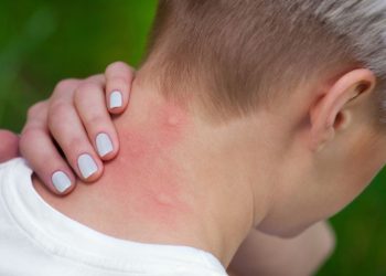 Fabriquer soi-même un spray anti-moustiques avec ces ingrédients