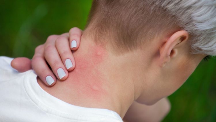 Fabriquer soi-même un spray anti-moustiques avec ces ingrédients