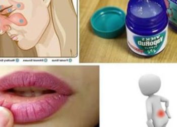 9 utilisations alternatives du Vicks VapoRub